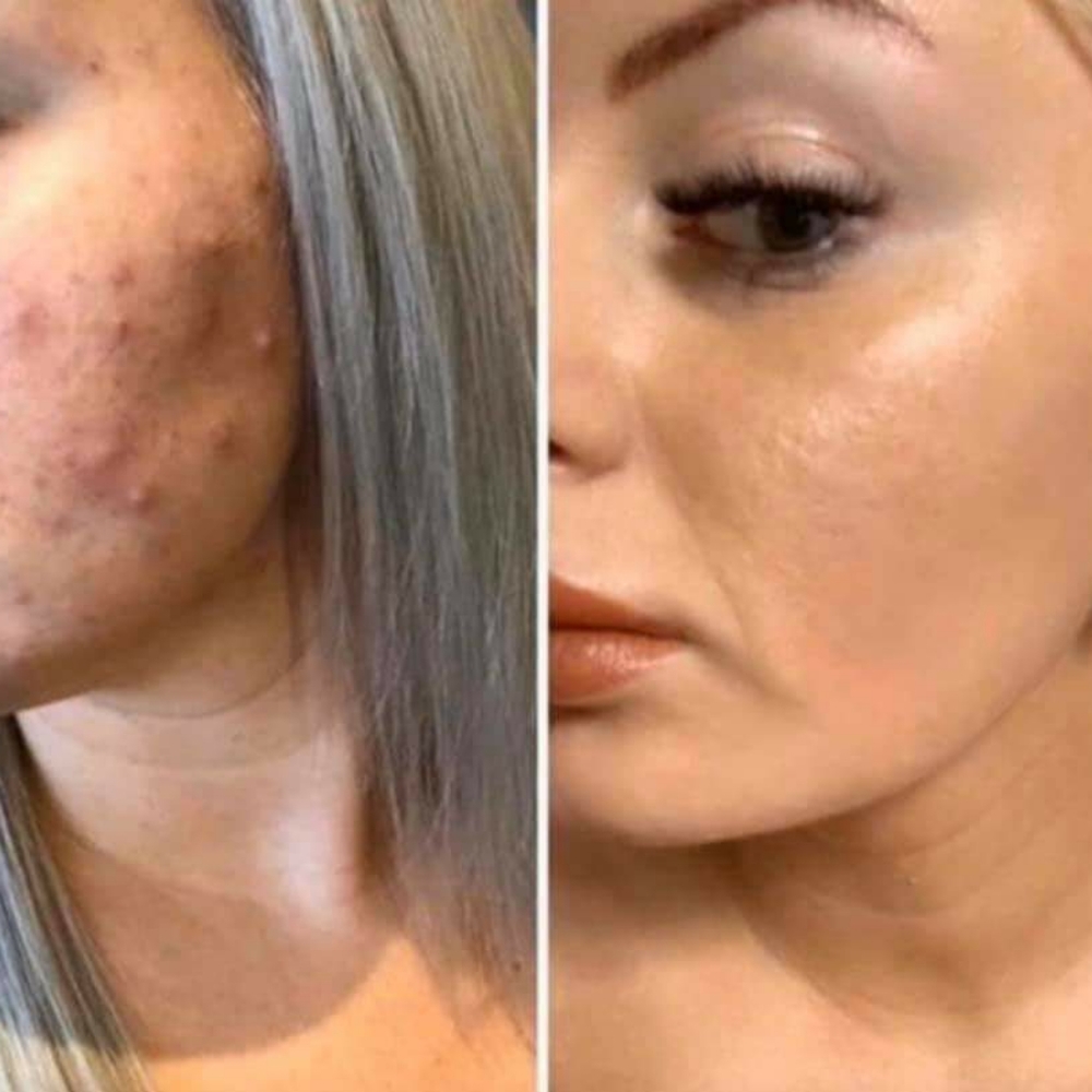 PREORDER ONLYRevolutionary Facial Cleansing Device